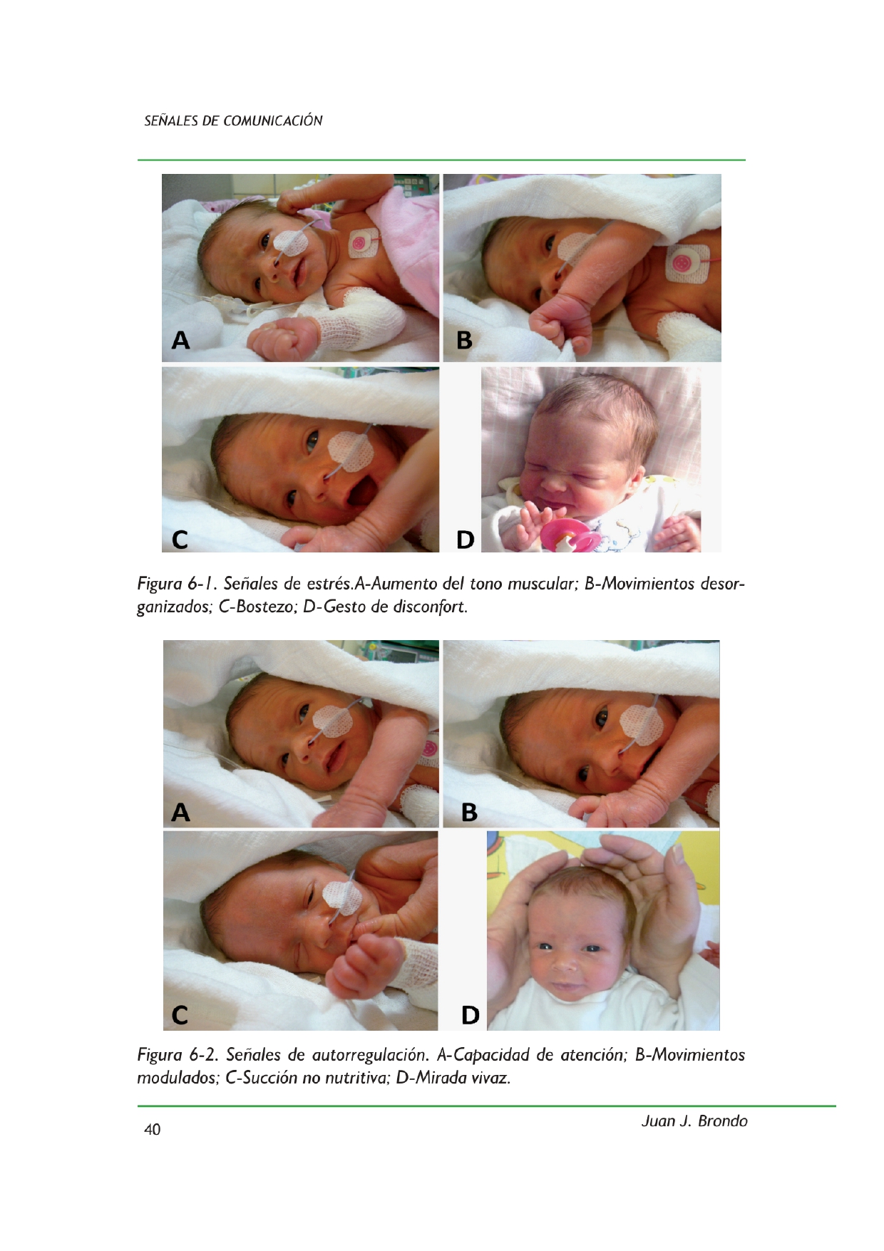 Leseprobe 1 Brondo Buch 2025 ABORDAJE NEUROHABILITATIVO EN NEONATOLOGÍA