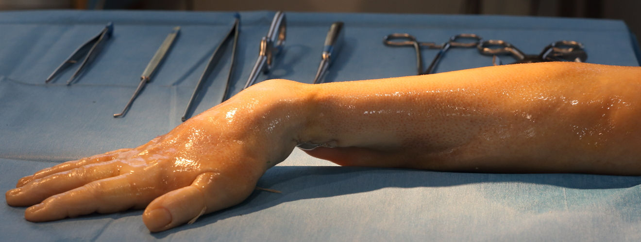 Ein präparierter Arm liegt auf einem Seziertisch